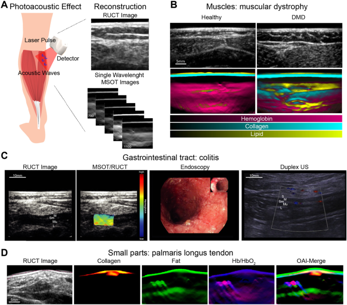 Visualizing the varying penetration depths of red and near-infrared light wavelengths into human tissue
