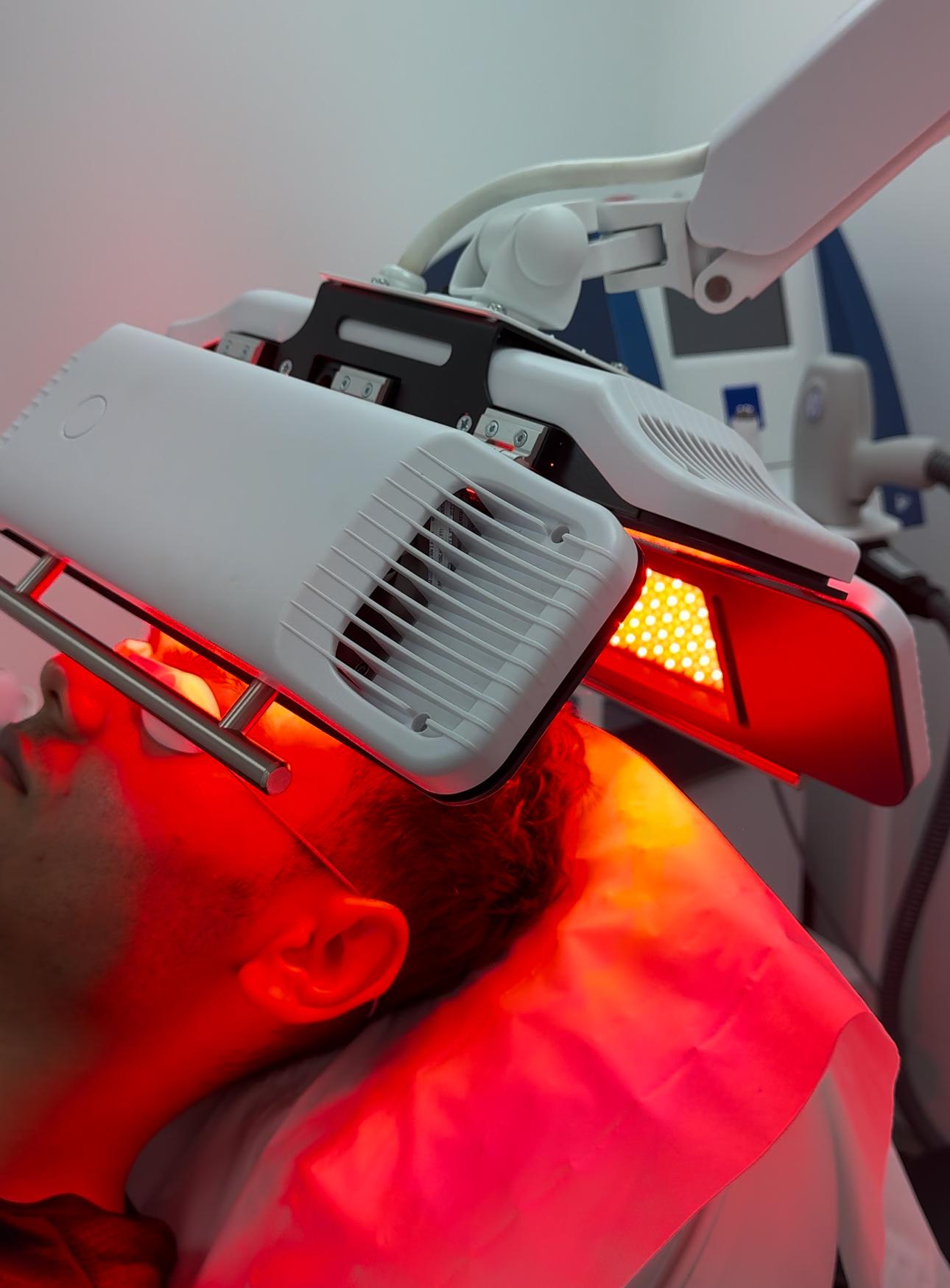 Red light therapy session targeting acne and skin inflammation, showing a gentle, soothing glow on the face